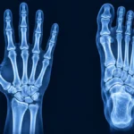 What Part of the Body Has the Most Bones?